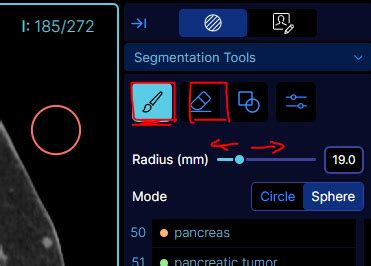 monai add channels